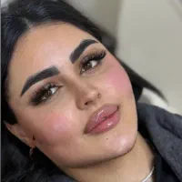 اف یلدایی ژل و بوتاکس|خدمات آرایشگری و زیبایی|اهواز, کوی ملی راه|دیوار