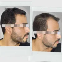 محصول معجزه اسا رویش مجددمو و ضدریزش در 83 روز|آرایشی، بهداشتی، درمانی|تهران, سعادت‌آباد|دیوار