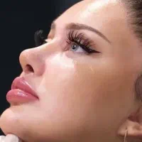 50درصد تخفیف جراحی عمل بینی لیپووابدوو ساکشن لیفت