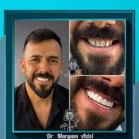 دندانپزشکی زیبایی و درمانی لمینت کامپوزیت دندان|خدمات آرایشگری و زیبایی|شیراز, معالی‌آباد|دیوار