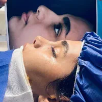 عمل جراحی بینی با تخفیف ویژه|خدمات آرایشگری و زیبایی|قم, باغ شازده|دیوار