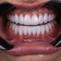 خدمات زیبایی و درمانی دکتر سعیده دارشی