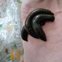 حجامت و زالو درمانی