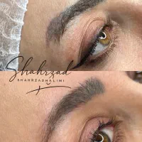 اجاره ورنت لیزر کیوسوییچپیکوشور بااپراتور حرفه ای|پزشکی|تهران, اقدسیه|دیوار