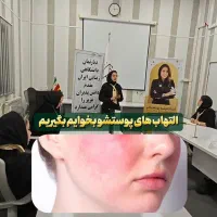 پوست مو و زیبایی|خدمات آموزشی|دورود, |دیوار