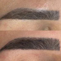 رویش مجدد موی ابرو