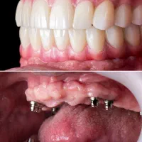 تمامی خدمات دندانپزشکی با بهترین کیفیت و اقساطی|خدمات آرایشگری و زیبایی|ماکو, |دیوار