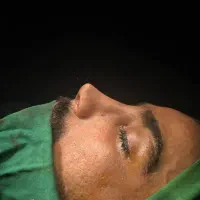 جراحی بینی متخصص جراح فک صورت ۴۵میلیون