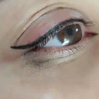تزریق تخصصی ژل لب تزریق بادی لیفت نخ و چربی|خدمات آرایشگری و زیبایی|خرمشهر, |دیوار