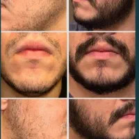 از ریش کم پشت تا ریش پرپشت
