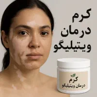 کرم درمان ویتیلیگو ( لکه های سفید )|آرایشی، بهداشتی، درمانی|تهران, فلسطین (میدان انقلاب)|دیوار