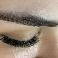 کاشت هیدن(موقت) و اکستنشن تخفیف به مدت یک هفته