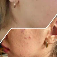 مشاور پوست مو و تغذیه