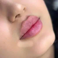 آموزش صفر تاصد ژل وبوتاکس