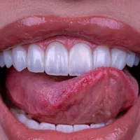 ایمپلنت دیجیتال/کامپوزیت/ لمینت/خدمات دندانپرشکی|خدمات آرایشگری و زیبایی|تهران, فردوس|دیوار