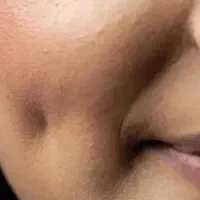 چال گونه  و پیرسینگ