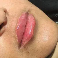 ژل بوتاکس|خدمات آرایشگری و زیبایی|دوگنبدان, |دیوار