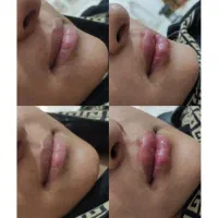 تخفیف ویژه سالن زیبایی مادلن