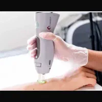 استخدام اپراتور خانم جهت لیزر موهای زائد