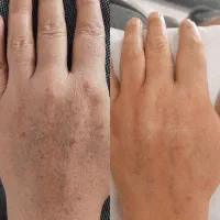 کرم اماراتی vip وایتکس پوست