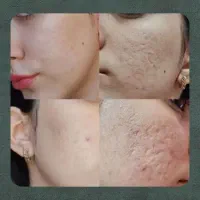 زیبایی صورتت با ایدولوژی روز دنیا