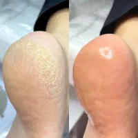 پدیکور ویژه بانوان