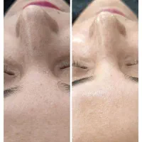 پاکسازی و فیشال بمدت سه روز تخفیف ویژه