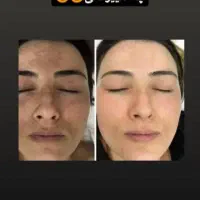 درمان مشکلات پوست