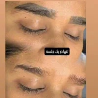 لیزر لک و لیزر کربن تراپی لاغری با کویتیشن و اراف|خدمات آرایشگری و زیبایی|فولادشهر, B4|دیوار