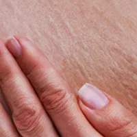 رفع تخصصی سلولیت