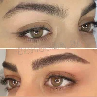 مدل میکروبلیدینگ و خط چشم