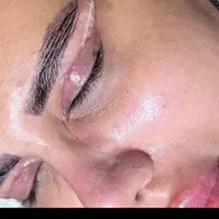 بلفا رو،بلفاروپلاستی،لیفت شقیقه،اتوپلاستی،ساکشن غب|خدمات آرایشگری و زیبایی|اهواز, نادری|دیوار