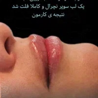 مطب زیبایی و لیزر با ده سال سابقه (فلکه جهاد)|خدمات آرایشگری و زیبایی|نورآباد ممسنی, |دیوار