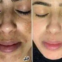 خدمات،آموزش ماساژ و حرکات اصلاحی +اصلاح سبک زندگی