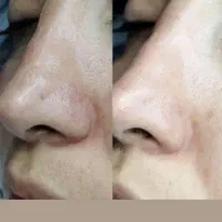 فشیال تخصصی با بهترین برند اکلدو|خدمات آرایشگری و زیبایی|برازجان, |دیوار