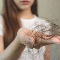 درمان ریشه‌ای ریزش مو (تضمین ۱۰۰٪ + ارسال رایگان)