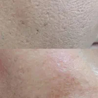 خدمات فوق تخصصی فیشیال اکستنشن و لیفت لمینت|خدمات آرایشگری و زیبایی|مشهد, توس (بلوار توس)|دیوار