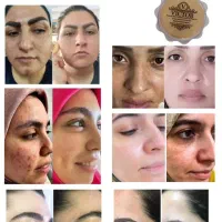 کرم فوقالعاده قوی ویکتور قیمت یک میلیون .|حراج|بروجرد, |دیوار