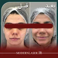 درمان کامل انواع لک پوستی توسط پزشک|خدمات آرایشگری و زیبایی|اصفهان, سعادت‌آباد|دیوار