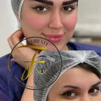 کاشت تخصصی مو و ابرو درمانگاه کمیل