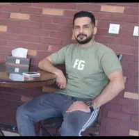 کاشت مو وابروی تخصصی فقط با ۱۳ میلیون تومان