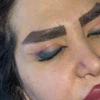 جشنواره تخفیفات بلفارو و ساکشن غبغب