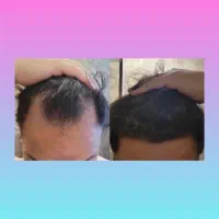 جنگل آمازون میشه