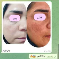 درمان بیماری هاباطب سنتی واصلاح مزاج