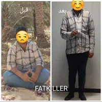 لاغری صد در صد تضمینی با دستگاه بدون عمل جراحی|خدمات آرایشگری و زیبایی|اهواز, پادادشهر|دیوار