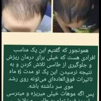 مشکل مو|آرایشی، بهداشتی، درمانی|رشت, کوی مهر|دیوار