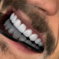 کامپوزیت صفر تا صد