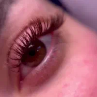 کاشت مژه ۳۰۰