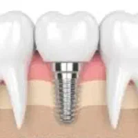 متخصص درمان ریشه ، متخصص ارتدونسی