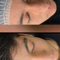 فیشال تخصصی صورت وایتنینگ بدن در کلینیک زیرنظرپزشک|خدمات آرایشگری و زیبایی|اسلامشهر, باغ فیض|دیوار